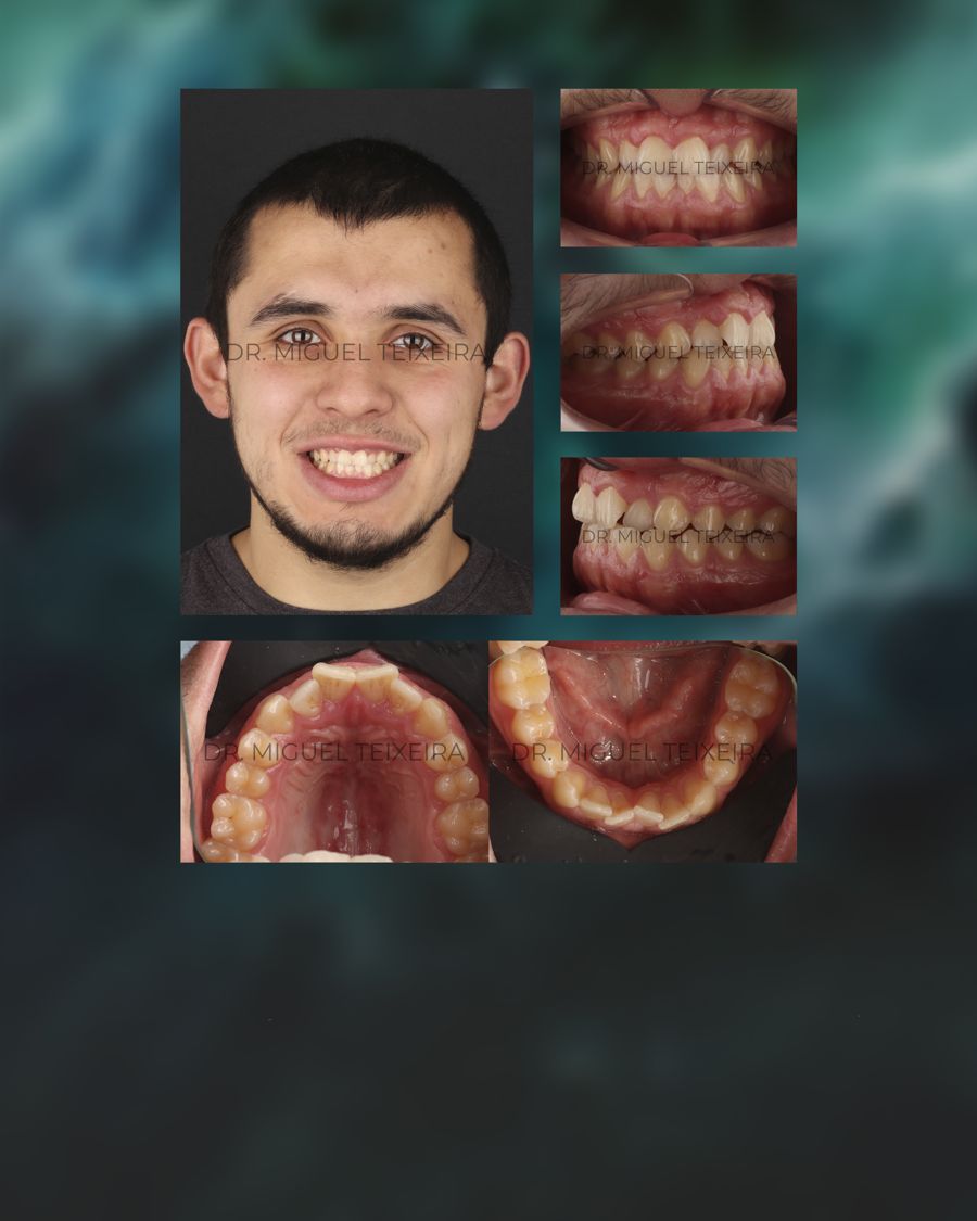 Revista de tratamientos realizados con ClearX